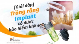 [Thắc mắc] Trồng răng Implant có được bảo hiểm không?