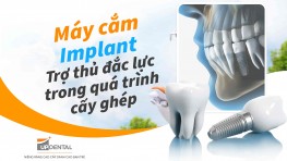 Máy cắm Implant: Trợ thủ đắc lực trong quá trình cấy ghép