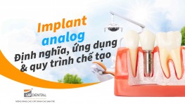 Implant analog: Định nghĩa, ứng dụng và quy trình chế tạo