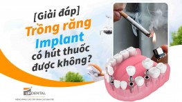 [Giải đáp] - Trồng răng Implant có hút thuốc được không?