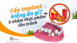[Giải đáp] - Cấy Implant kiêng ăn gì? 5 nhóm thực phẩm cần tránh