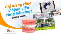 Giá niềng răng ở bệnh viện răng hàm mặt trung ương [Cập nhật] 