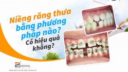 Niềng răng thưa bằng phương pháp nào? Có hiệu quả không?