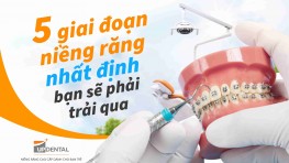 5 giai đoạn niềng răng nhất định bạn sẽ phải trải qua