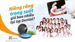Niềng răng trong suốt giá bao nhiêu [2026] tại Up Dental