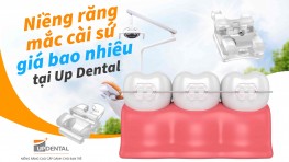 Niềng răng mắc cài sứ giá bao nhiêu [2026] tại Up Dental