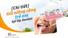 Giá niềng răng trẻ em tại Up Dental [2026]