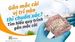 Gắn mắc cài vị trí nào thì chuẩn xác? Tìm hiểu quy trình gắn mắc cài