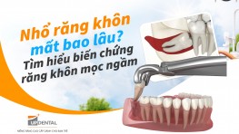 Nhổ răng khôn mất bao lâu? Tìm hiểu biến chứng răng khôn mọc ngầm