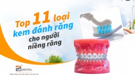 Top 11 loại kem đánh răng cho người niềng răng