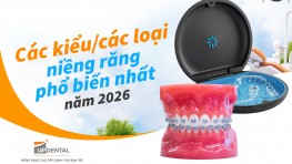 Các kiểu/các loại niềng răng phổ biến nhất năm 2026