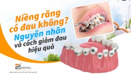 [Tìm hiểu] Niềng răng có đau không? Nguyên nhân và cách giảm đau hiệu quả