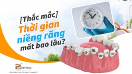 [Thắc mắc] Thời gian niềng răng mất bao lâu?