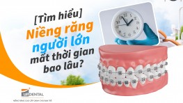 [Tìm hiểu] Niềng răng người lớn mất thời gian bao lâu?