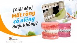 [Giải đáp] Mất răng có niềng được không?