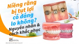 Niềng răng bị tụt lợi có đáng lo không? Nguyên nhân & cách khắc phục