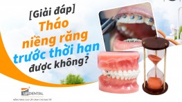 [Giải đáp] Tháo niềng răng trước thời hạn được không?