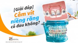 [Giải đáp] Cắm vít niềng răng có đau không?