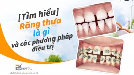 [Tìm hiểu] Răng thưa là gì và các phương pháp điều trị