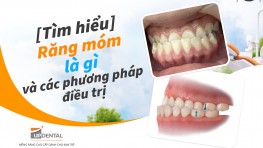 [Tìm hiểu] Răng móm là gì và các phương pháp điều trị