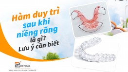 Hàm duy trì sau khi niềng răng là gì? Lưu ý cần biết