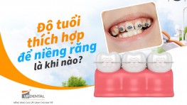Độ tuổi thích hợp để niềng răng là khi nào?
