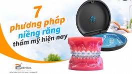 07 phương pháp niềng răng thẩm mỹ hiện nay