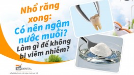 Nhổ răng xong: Có nên ngậm nước muối không? Làm gì để không bị viêm nhiễm?
