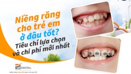 Niềng răng cho trẻ em ở đâu tốt? Tiêu chí lựa chọn và chi phí mới nhất