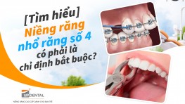 [Tìm hiểu] Niềng răng nhổ răng số 4 có phải là chỉ định bắt buộc?