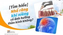 [Tìm hiểu] Nhổ răng khi niềng có ảnh hưởng thần kinh không?