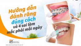Hướng dẫn đánh răng đúng cách và 4 sai lầm mắc phải mỗi ngày