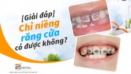 [Giải đáp] Chỉ niềng răng cửa có được không?