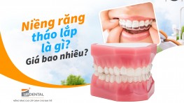 Niềng răng tháo lắp là gì? Giá bao nhiêu?