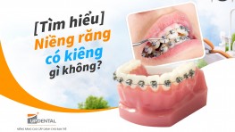 [Tìm hiểu] Niềng răng có kiêng gì không? 