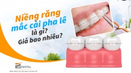 Niềng răng mắc cài pha lê là gì? Giá bao nhiêu?
