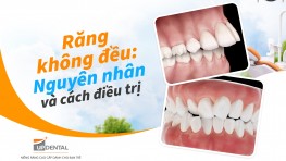 Răng không đều: Nguyên nhân và cách điều trị