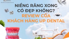 Niềng răng xong có đẹp không? Review của Khách hàng Up Dental