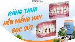 [Giải đáp] Răng thưa nên niềng hay bọc sứ?