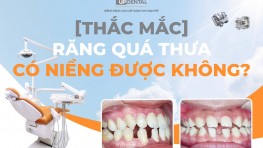 [Thắc mắc] Răng quá thưa có niềng được không?