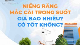 Niềng răng mắc cài trong suốt giá bao nhiêu? Có tốt không?