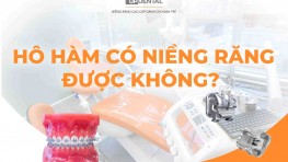 [Giải đáp] Hô hàm có niềng răng được không?