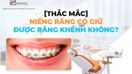 [Thắc mắc] Niềng răng có giữ được răng khểnh không?