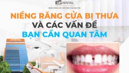Niềng răng cửa bị thưa và các vấn đề bạn cần quan tâm