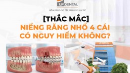 [Thắc mắc] Niềng răng nhổ 4 cái có nguy hiểm không?