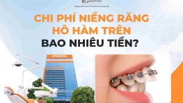 Chi phí niềng răng hô hàm trên bao nhiêu tiền? [2026]