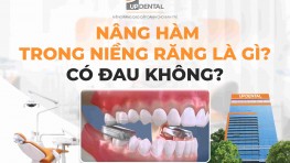 Nâng hàm trong niềng răng là gì? Có đau không?