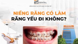 [Giải đáp] Niềng răng có làm răng yếu đi không?