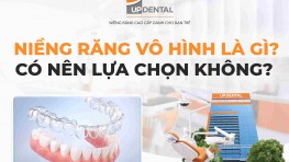 [Tìm hiểu] Niềng răng vô hình là gì? Có nên lựa chọn không?