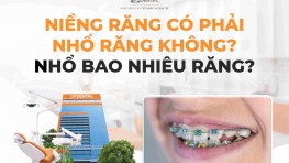 Niềng răng có phải nhổ răng không? Nhổ bao nhiêu răng?